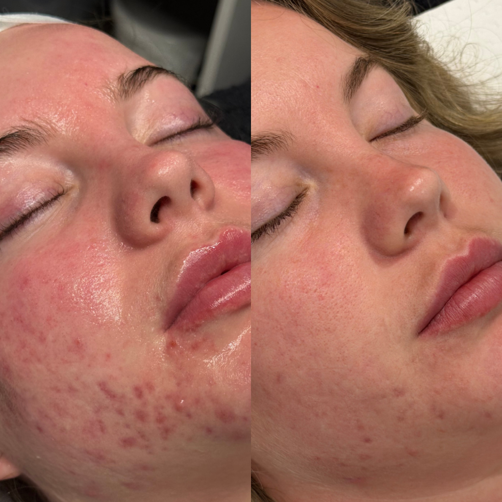 Revitalizing Boosting Serum