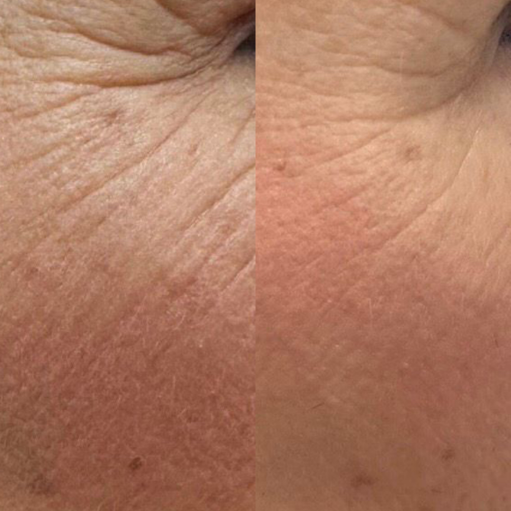 The Anti-Ageing Reset Duo